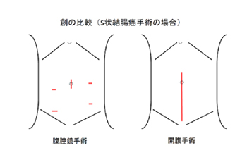 創の比較