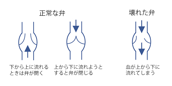 健診診断後の保健指導