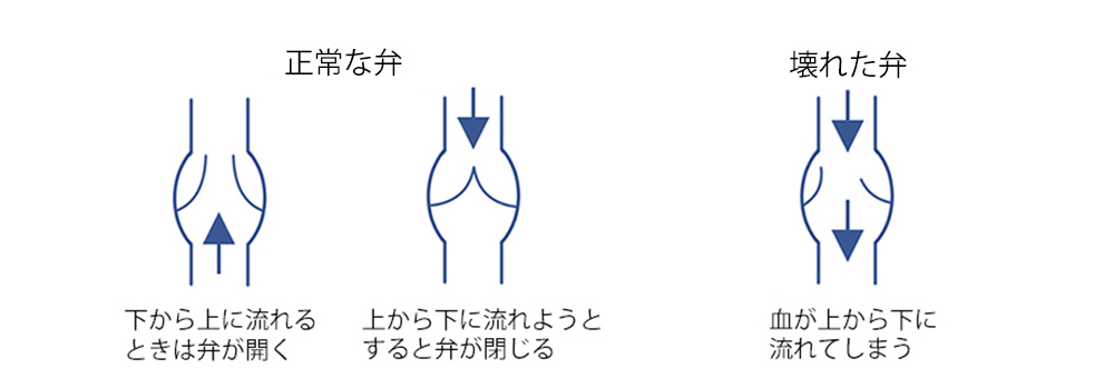 健診診断後の保健指導