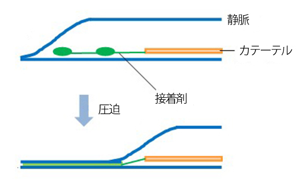 健診診断後の保健指導